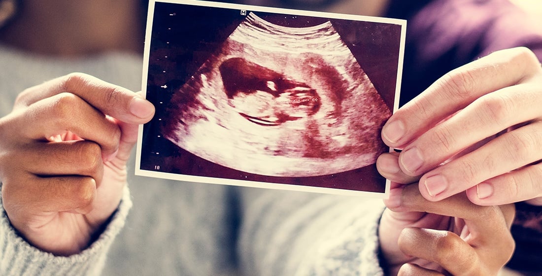 hands holding ultrasound photo